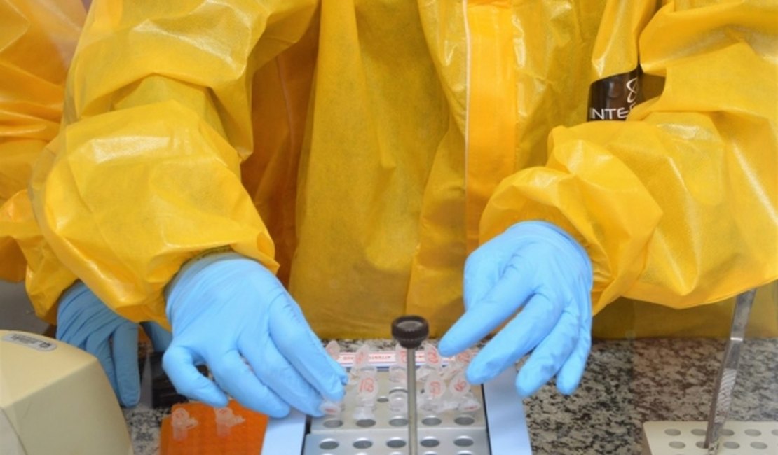 Estado vai ampliar exame de RT-PCR para alagoanos com síndrome gripal
