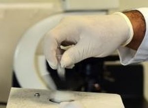 Brasil tem primeiro teste rápido nacional para zika; resultado sai em 20 minutos