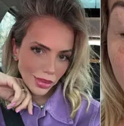 Apresentadora é infectada por bactéria com poder de cegar