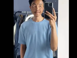 Homem contrai infecção viral após usar roupa de brechó sem lavar
