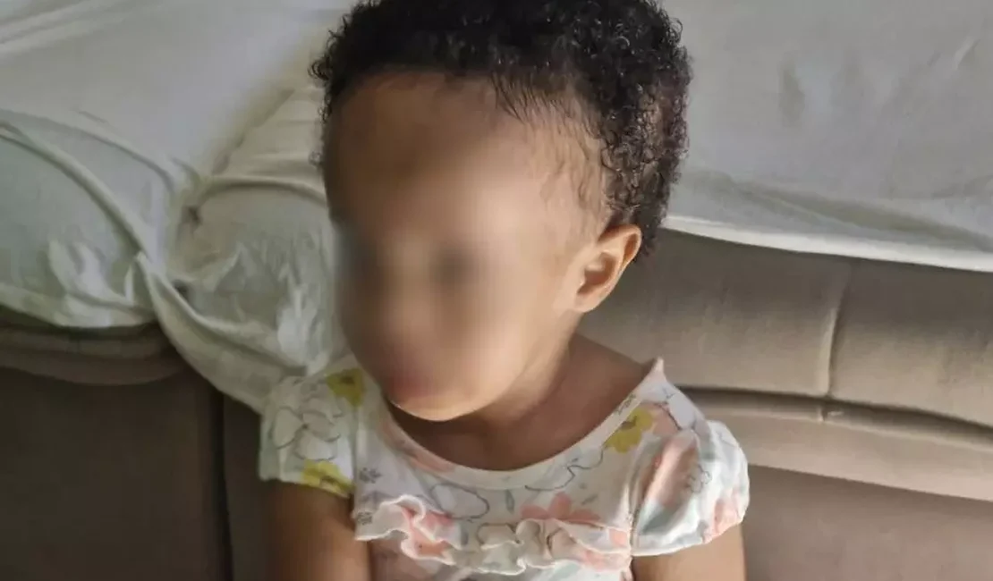 Família busca arrecadar R$ 87 mil para cirurgia rara de criança no cérebro