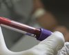 Licitação de laboratório envolvido em infecção por HIV será investigada