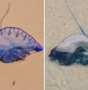Jovem sofre queimaduras de caravelas no rosto, na Praia do Francês