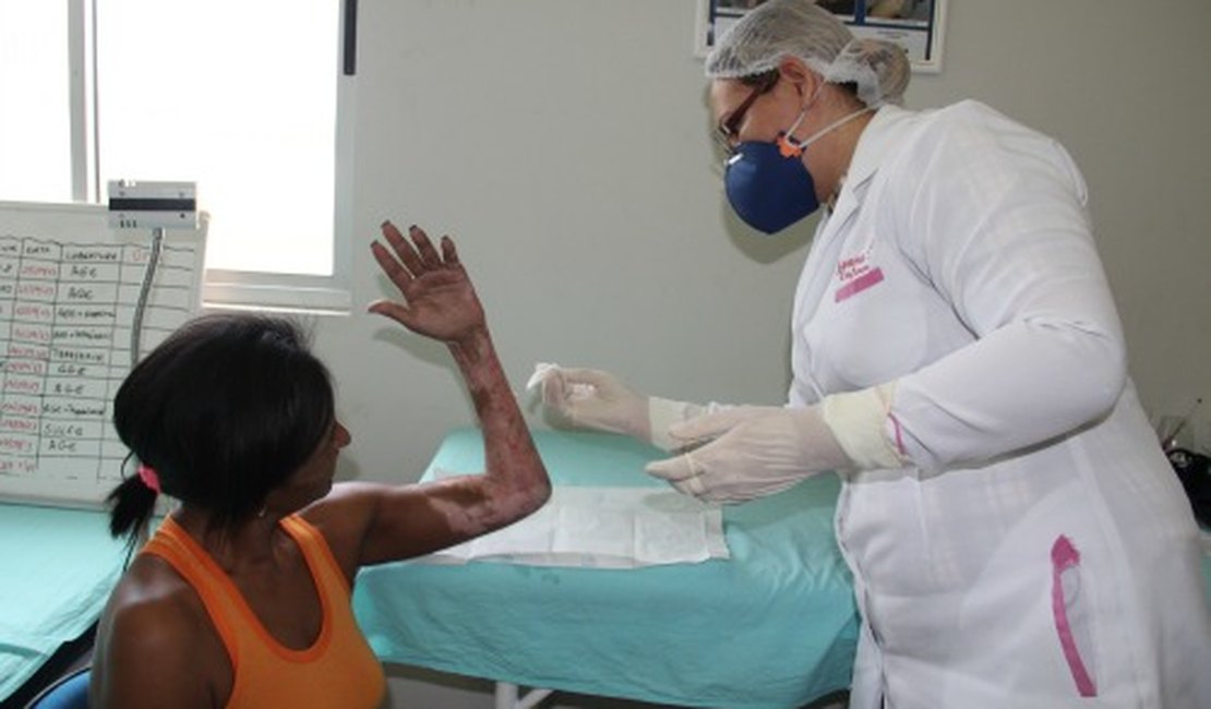 Arapiraca é a única cidade do Estado com Ambulatório de Feridas