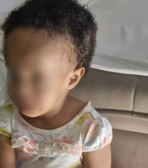 Família busca arrecadar R$ 87 mil para cirurgia rara de criança no cérebro