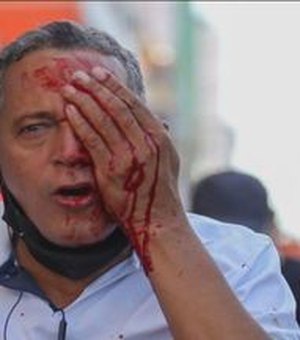 Governo de Pernambuco vai indenizar feridos pela PM durante manifestação