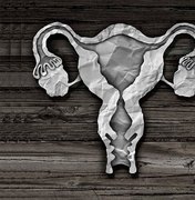 Homem passa 20 anos menstruando e descobre que tem útero e ovários