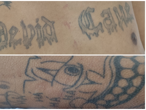 Hospital de Emergência do Agreste procura familiares de paciente identificado apenas como Rafael