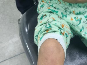 Trauma e hematomas: menino vítima de maus-tratos em Maceió é entregue ao pai
