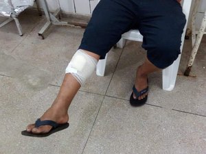 Tentativa de assalto a ônibus deixa homem baleado na BR 101, em Flexeiras