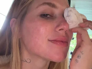 Virginia surge com lesão no olho após acidente envolvendo a filha