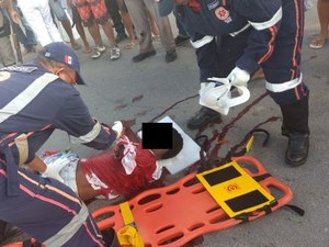 Adolescente tem braço amputado em colisão entre carro e moto na AL-465 Norte