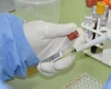 Com 7 casos este ano em Alagoas, Sesau reforça medidas de prevenção contra meningite