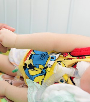 ?Justiça determina que criança com microcefalia receba tratamento em casa