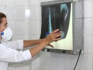 OMS: tratamento da tuberculose não deve ser descuidado