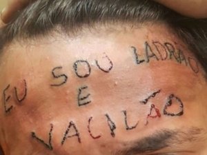 Coletivo arrecada quase R$ 20 mil para apagar tatuagem da testa de adolescente