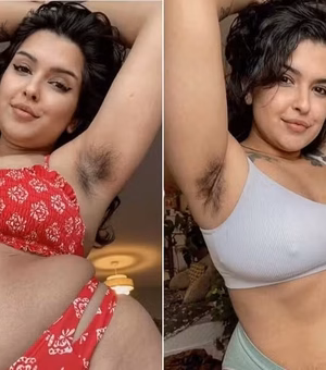 Ex-estudante de medicina faz 'fortuna' com pelos nas axilas e critica Kim Kardashian