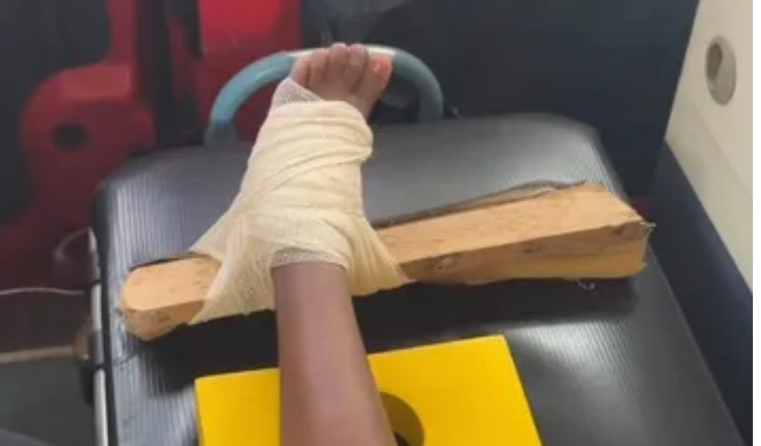 Criança de 10 anos fura o pé em prego e é socorrida pelos bombeiros em Arapiraca