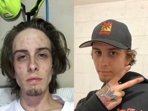 Jovem viraliza com fotos antes e depois de largar drogas: “Finalmente vivo”