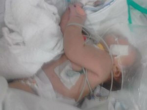 Três dias após nascer, bebê é picada cinco vezes por escorpião e sobrevive