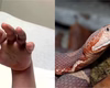 Menino de 4 anos é picado por cobra venenosa, e creche não aciona emergência: 'Achei que fosse uma farpa'