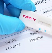 Palmeira dos Índios tem 1.619 casos confirmados de Coronavírus