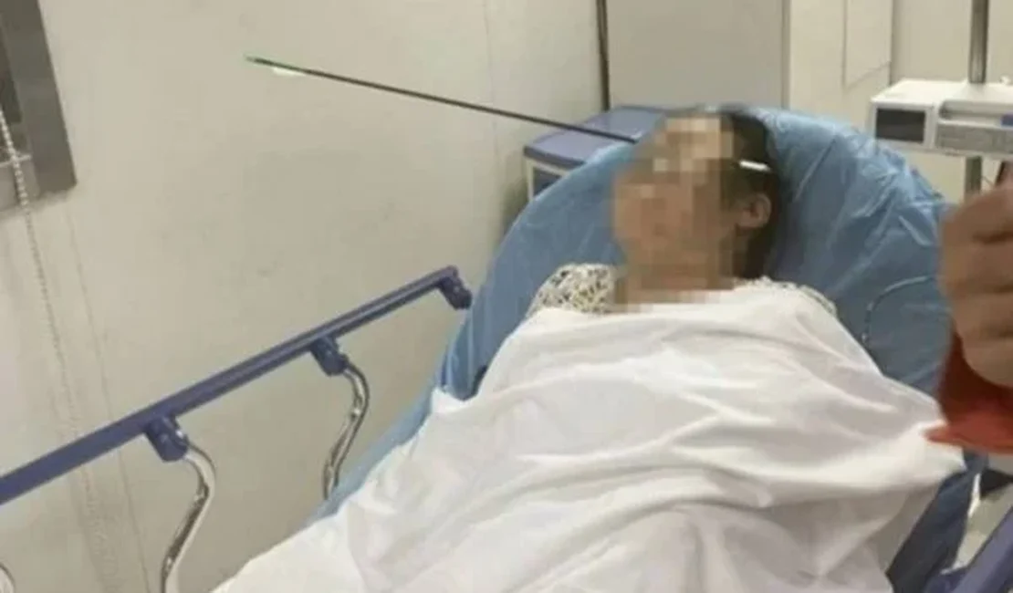 Mulher tem rosto atravessado por flecha de aço de 70 cm na China