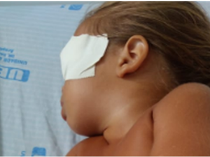 Médico avalia bebê que sofreu acidente doméstico e diz que sua visão pode ser restabelecida