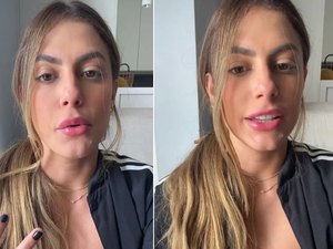 Mari Gonzalez justifica lipo na axila: 'Gordurinha que incomodava'