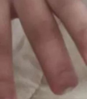 Criança tem dedo cortado por professora após desobediência em sala de aula