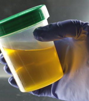 Cientistas registram primeiro caso de pessoa que urina álcool