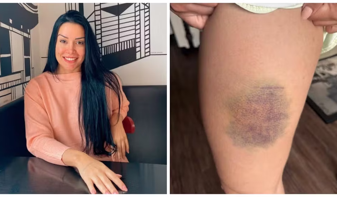 Nutricionista lutou por 13 minutos contra agressor que invadiu sua casa para estuprá-la: 'Briguei pela vida'