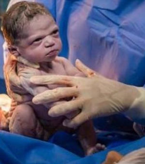 Família sabia que 'bebê brava' viraria meme, segundo fotógrafo do parto