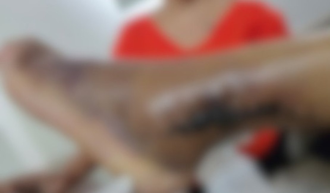 Família acusa plano de saúde de série de negligências que provocaram risco de amputação em pé de idosa