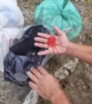 Coletor de lixo tem a mão perfurada por objeto cortante descartado incorretamente em Penedo