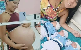 Mulher com 1,45 metro surpreende médicos ao dar à luz trigêmeos
