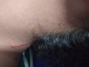 Adolescente de 14 anos é agredida por colegas de escola em Maceió