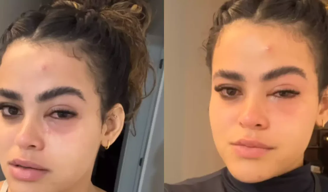 'Mosquinha parece ser inofensiva, mas não é', diz jovem que viralizou após infecção ocular