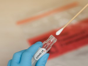 Mulheres são mais infectadas pelo coronavírus, mas homens morrem mais, segundo dados de Arapiraca