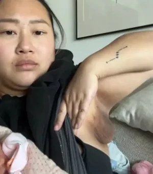 Mulher viraliza ao relatar terceiro seio durante amamentação