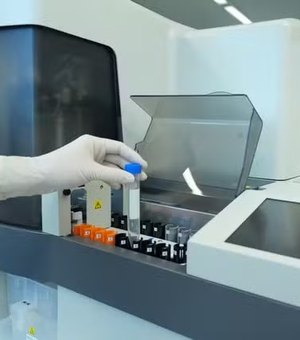Exame de sangue para Alzheimer chega ao Brasil; veja quanto custa