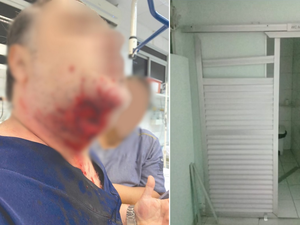 Paciente morde pescoço de médico e por pouco jugular não foi atingida 