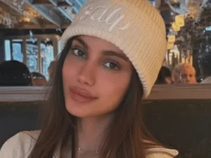 Anitta aparece com rosto diferente e web reage. Veja antes e depois