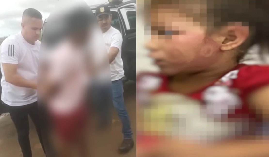 [Vídeo] Criança de 6 anos aparece na escola com marca de 'chinelada' no rosto e pai é preso