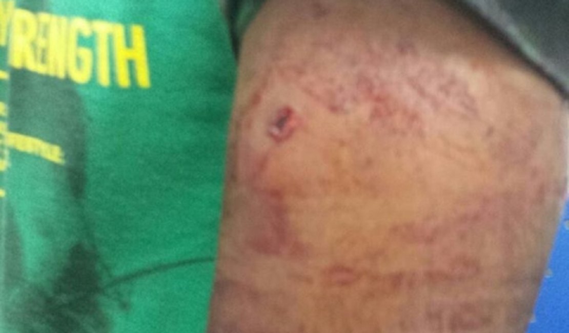 Jovem é baleado na saída de clube social de Arapiraca