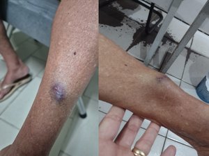 Médica é denunciada pelo MPAL por agredir tia idosa de 77 anos em Arapiraca