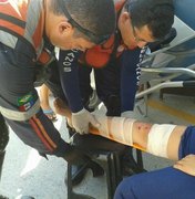 Acidente entre duas motos deixa mulher ferida em Arapiraca