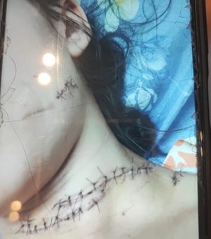 Preso homem que invadiu casa da ex em Maceió e a esfaqueou enquanto dormia