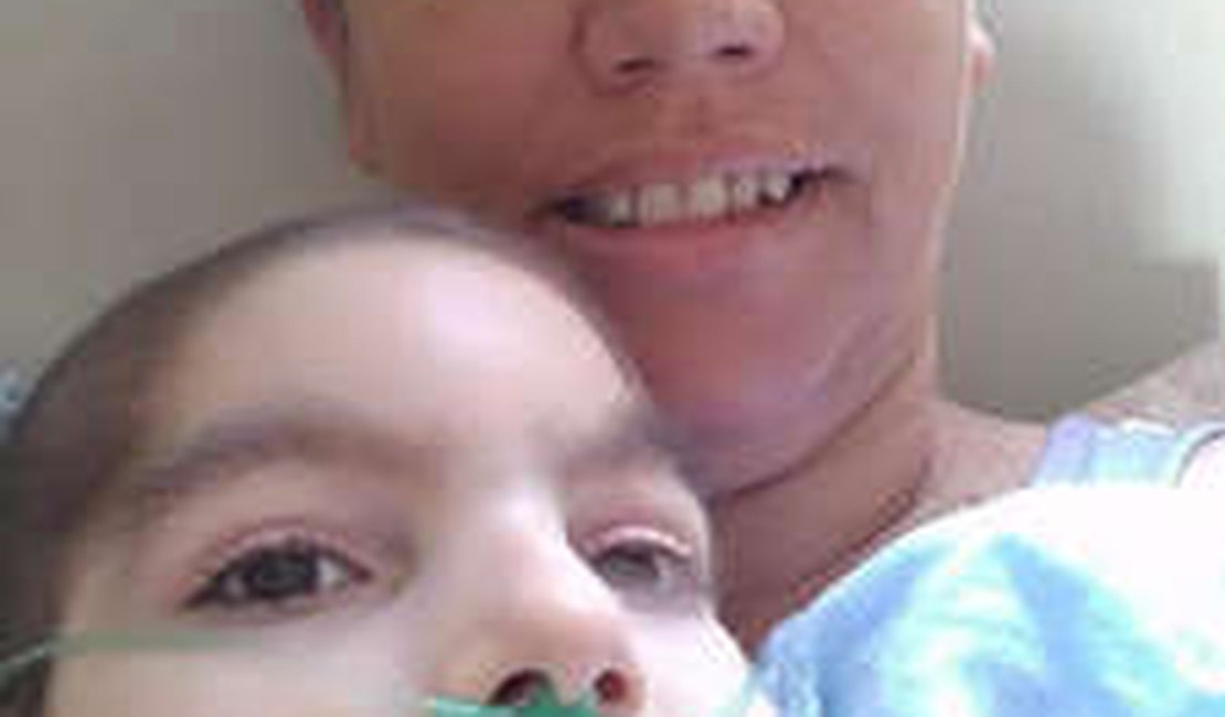 Mãe e filho com microcefalia morrem de Covid-19 com 18 dias de diferença