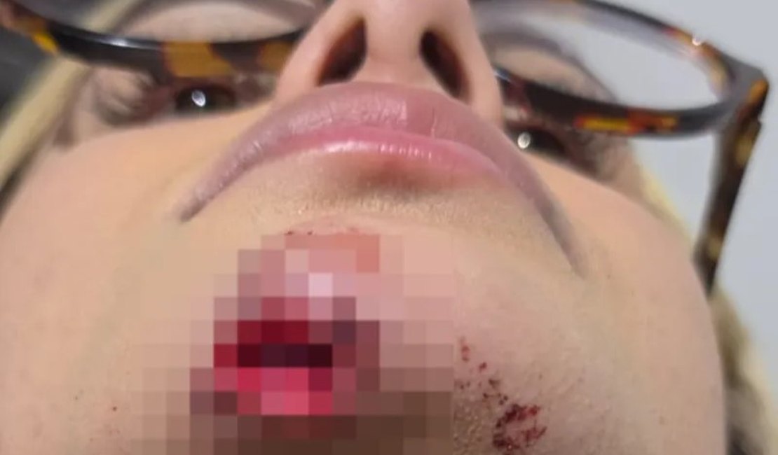 Influenciadora relata agressão de ex e diz ter sido arrastada no asfalto por mais de 100 metros